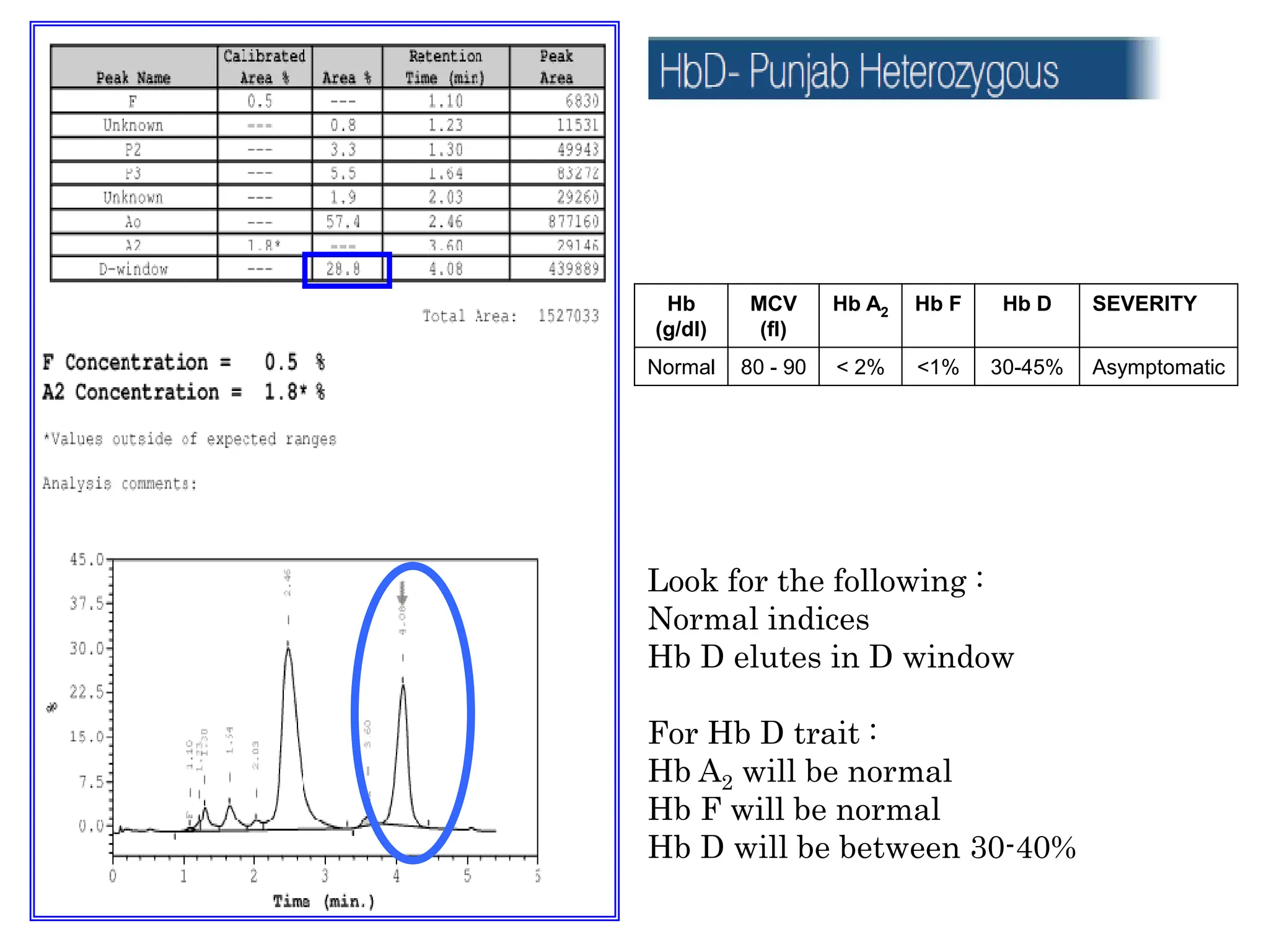 High Performance Liquid chromatography INTERPRETATION.ppt
