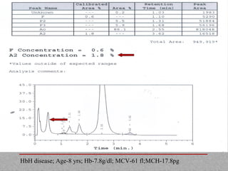 HbH disease; Age-8 yrs; Hb-7.8g/dl; MCV-61 fl;MCH-17.8pg
 