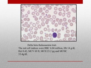 Delta beta thalassaemia trait.
The red cell indices were RBC 6.04 million, Hb 14 g/dl,
Hct 0.42, MCV 69 fl, MCH 23.2 pg and MCHC
33.4g/dl;
 