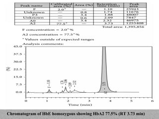 Chromatogram of HbE homozygous showing HbA2 77.5% (RT 3.73 min)
 