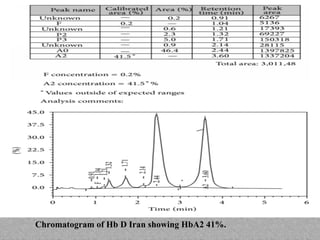 Chromatogram of Hb D Iran showing HbA2 41%.
 