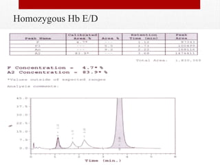 Homozygous Hb E/D
 