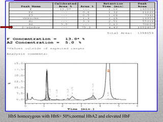 HbS homozygous with HbS> 50%;normal HbA2 and elevated HbF
 