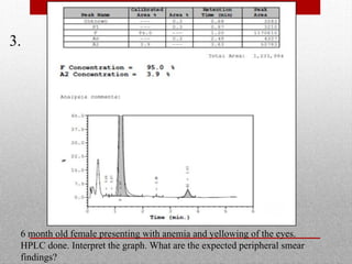 3.
6 month old female presenting with anemia and yellowing of the eyes.
HPLC done. Interpret the graph. What are the expected peripheral smear
findings?
 