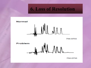 Resolution Failure hplc trouble shooting - final.ppt