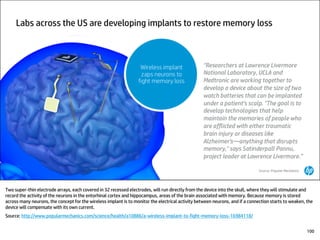 Two super-thin electrode arrays, each covered in 32 recessed electrodes, will run directly from the device into the skull, where they will stimulate and
record the activity of the neurons in the entorhinal cortex and hippocampus, areas of the brain associated with memory. Because memory is stored
across many neurons, the concept for the wireless implant is to monitor the electrical activity between neurons, and if a connection starts to weaken, the
device will compensate with its own current.
Source: http://www.popularmechanics.com/science/health/a10886/a-wireless-implant-to-fight-memory-loss-16984118/
100
 