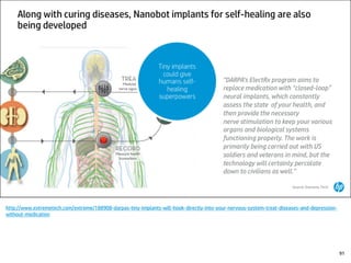 http://www.extremetech.com/extreme/188908-darpas-tiny-implants-will-hook-directly-into-your-nervous-system-treat-diseases-and-depression-
without-medication
91
 