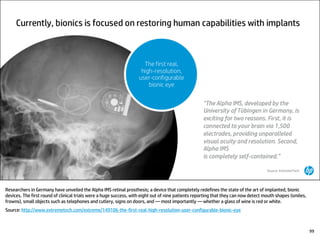 Researchers in Germany have unveiled the Alpha IMS retinal prosthesis; a device that completely redefines the state of the art of implanted, bionic
devices. The first round of clinical trials were a huge success, with eight out of nine patients reporting that they can now detect mouth shapes (smiles,
frowns), small objects such as telephones and cutlery, signs on doors, and — most importantly — whether a glass of wine is red or white.
Source: http://www.extremetech.com/extreme/149106-the-first-real-high-resolution-user-configurable-bionic-eye
99
 