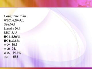 Công thức máu:
WBC: 6,59k/UL
Neu:70,4
Lympho 20,9
RBC 3,45
HGB 8,3g/dl
HCT:27,8%
MCV 80,6
MCH 24,1
WBC 14,4%
PLT   585
 