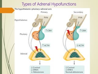 Hpofunction of adrenal cortex | PPTX