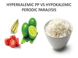 HYPERKALEMIC PP VS HYPOKALEMIC 
PERODIC PARALYSIS 
 