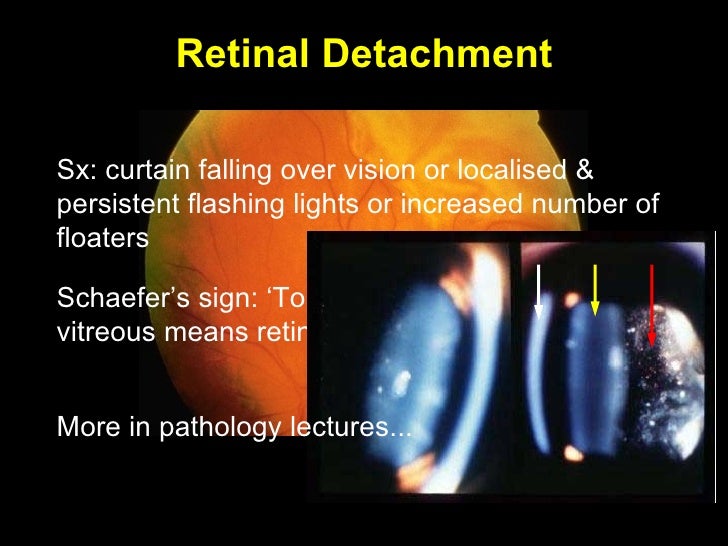 Ocular Diff Diaganosis 1