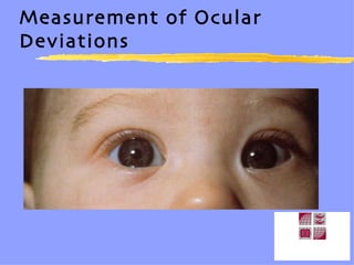 Measurement of Ocular Deviations 