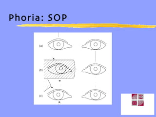 Phoria: SOP 