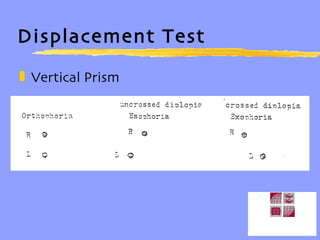 Displacement Test Vertical Prism 