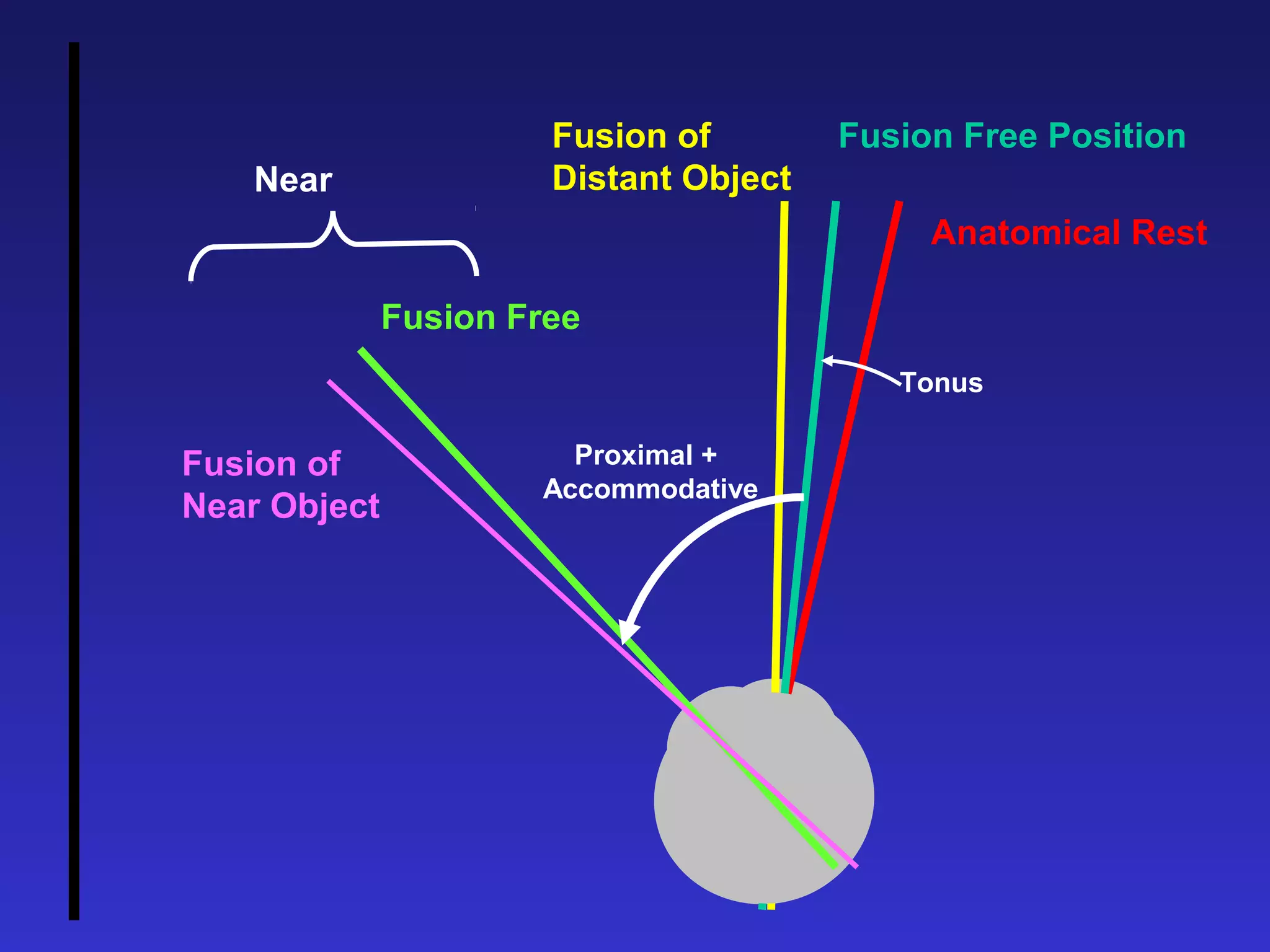 Anatomical Rest
Fusion Free PositionFusion of
Distant ObjectNear
Fusion Free
Fusion of
Near Object
Tonus
Proximal +
Accommodative
 