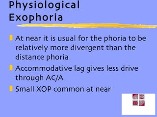 Physiological Exophoria At near it is usual for the phoria to be relatively more divergent than the distance phoria Accommodative lag gives less drive through AC/A Small XOP common at near 