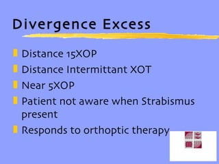 Divergence Excess Distance 15XOP Distance Intermittant XOT Near 5XOP Patient not aware when Strabismus present Responds to orthoptic therapy 