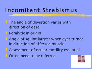 Incomitant Strabismus The angle of deviation varies with direction of gaze Paralytic in origin Angle of squint largest when eyes turned in direction of affected muscle Assessment of ocular motility essential Often need to be referred 