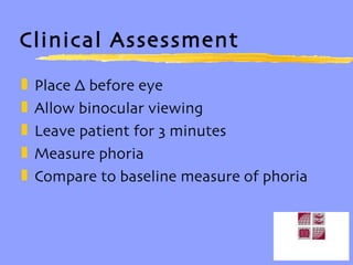 Clinical Assessment Place ∆ before eye Allow binocular viewing Leave patient for 3 minutes Measure phoria Compare to baseline measure of phoria