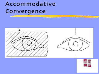 Accommodative Convergence 