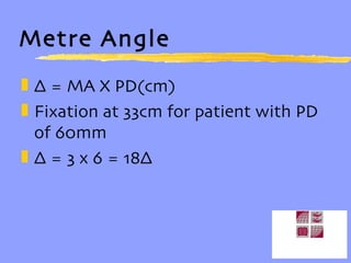 Metre Angle ∆  = MA X PD(cm) Fixation at 33cm for patient with PD of 60mm ∆  = 3 x 6 = 18∆ 
