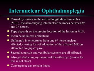 Internuclear Ophthalmoplegia Caused by lesions in the medial longitudinal fasciculus (MLF), the area carrying internuclear neurones between 6 th  and 3 rd  nerves. Type depends on the precise location of the lesion in MLF.  It can be unilateral or bilateral: Unilateral: interneurones from one 6 th  nerve nucleus affected, causing loss of adduction of the affected MR on attempted conjugate gaze. Saccadic, pursuit and vestibular systems are all affected. Also get abducting nystagmus of the other eye (reason for this is not clear) Convergence can remain intact 