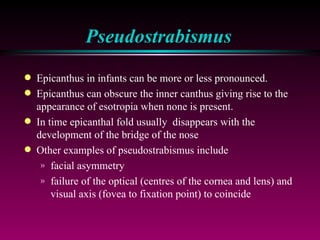 Pseudostrabismus Epicanthus in infants can be more or less pronounced. Epicanthus can obscure the inner canthus giving rise to the appearance of esotropia when none is present. In time epicanthal fold usually  disappears with the development of the bridge of the nose Other examples of pseudostrabismus include  facial asymmetry failure of the optical (centres of the cornea and lens) and visual axis (fovea to fixation point) to coincide 