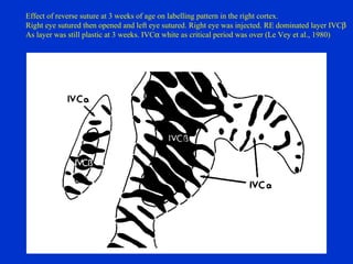 Effect of reverse suture at 3 weeks of age on labelling pattern in the right cortex. Right eye sutured then opened and left eye sutured. Right eye was injected. RE dominated layer IVC    As layer was still plastic at 3 weeks. IVC   white as critical period was over (Le Vey et al., 1980) 