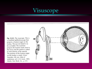 Visuscope 