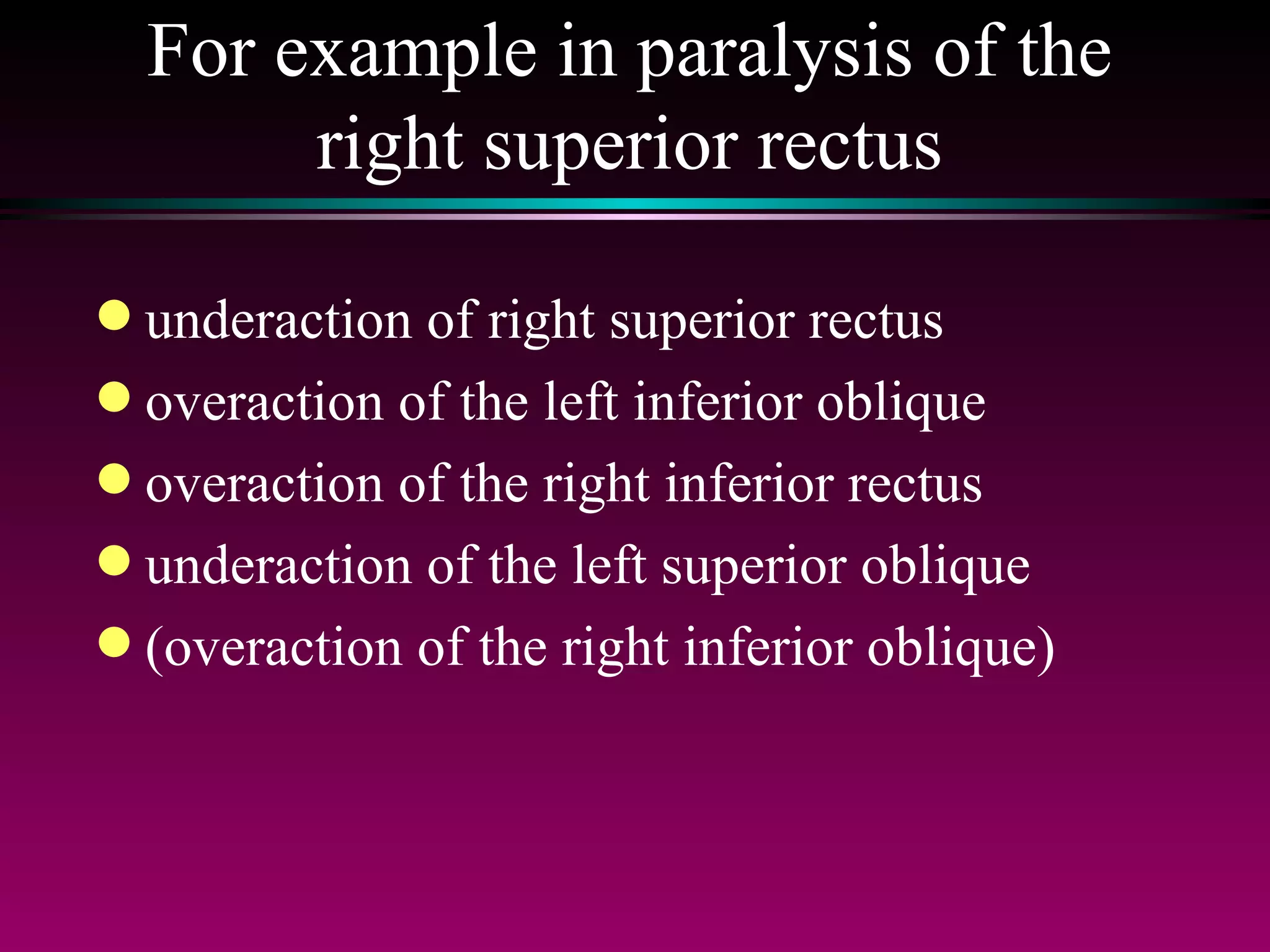 For example in paralysis of the right superior rectus underaction of right superior rectus overaction of the left inferior oblique overaction of the right inferior rectus underaction of the left superior oblique (overaction of the right inferior oblique) 