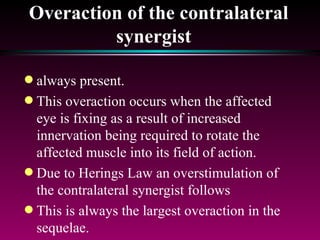 Overaction of the contralateral synergist   always present.  This overaction occurs when the affected eye is fixing as a result of increased innervation being required to rotate the affected muscle into its field of action.  Due to Herings Law an overstimulation of the contralateral synergist follows This is always the largest overaction in the sequelae. 
