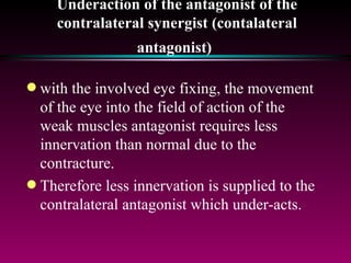 Underaction of the antagonist of the contralateral synergist (contalateral antagonist)   with the involved eye fixing, the movement of the eye into the field of action of the weak muscles antagonist requires less innervation than normal due to the contracture. Therefore less innervation is supplied to the contralateral antagonist which under-acts. 
