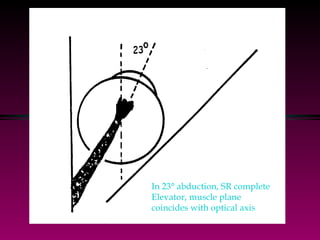 In 23° abduction, SR complete  Elevator, muscle plane  coincides with optical axis 