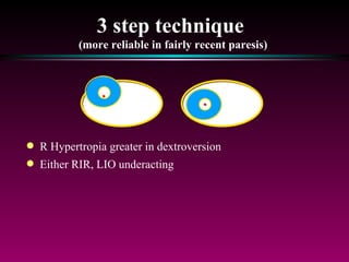 3 step technique  (more reliable in fairly recent paresis) R Hypertropia greater in dextroversion  Either RIR, LIO underacting 