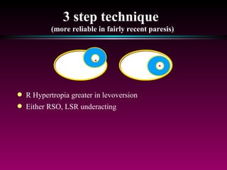 3 step technique  (more reliable in fairly recent paresis) R Hypertropia greater in levoversion  Either RSO, LSR underacting 