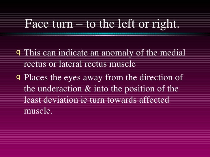 paralytic strabismus
