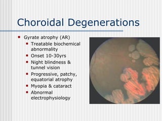 Choroidal Degenerations Gyrate atrophy (AR) Treatable biochemical abnormality Onset 10-30yrs Night blindness & tunnel vision Progressive, patchy, equatorial atrophy Myopia & cataract Abnormal electrophysiology 