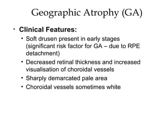 Geographic Atrophy (GA) Clinical Features: Soft drusen present in early stages (significant risk factor for GA – due to RPE detachment) Decreased retinal thickness and increased visualisation of choroidal vessels  Sharply demarcated pale area Choroidal vessels sometimes white 