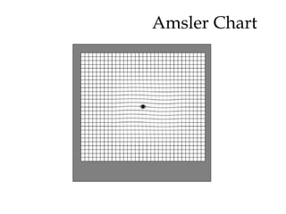 Amsler Chart  