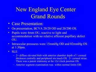 New England Eye Center  Grand Rounds Case Presentation: On presentation, BCVA 20/20 OD and 20/200 OS.  Pupils were 4mm OU, reactive to light and accommodation with no relative afferent pupillary defect OU. Intraocular pressures were 15mmHg OD and 02mmHg OS at 1:30pm.  SLE  2+ diffuse elevated bleb with anterior chamber depth of 1 corneal thickness centrally and peripheral iris touch OS.  2+ corneal striae. There was a patent iridotomy at the 12o’clock position OS.  Anterior segment examination was  within normal limits OD. 