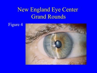 New England Eye Center  Grand Rounds Figure 4 