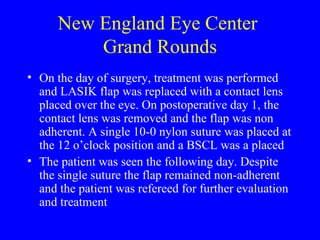 New England Eye Center  Grand Rounds On the day of surgery, treatment was performed and LASIK flap was replaced with a contact lens placed over the eye. On postoperative day 1, the contact lens was removed and the flap was non adherent. A single 10-0 nylon suture was placed at the 12 o’clock position and a BSCL was a placed The patient was seen the following day. Despite the single suture the flap remained non-adherent and the patient was refereed for further evaluation and treatment 