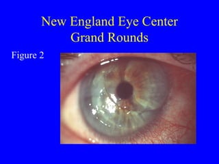 New England Eye Center Grand Rounds Figure 2 