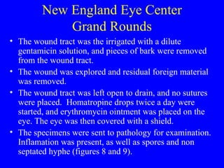 New England Eye Center Grand Rounds The wound tract was the irrigated with a dilute gentamicin solution, and pieces of bark were removed from the wound tract.  The wound was explored and residual foreign material was removed.  The wound tract was left open to drain, and no sutures were placed.  Homatropine drops twice a day were started, and erythromycin ointment was placed on the eye. The eye was then covered with a shield. The specimens were sent to pathology for examination. Inflamation was present, as well as spores and non septated hyphe (figures 8 and 9). 