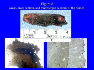 Figure 8 Gross, cross section, and microscopic sections of the branch. 