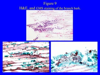 Figure 9 H&E, and  GMS staining of the branch bark. 