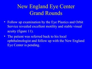 New England Eye Center Grand Rounds Follow up examination by the Eye Plastics and Orbit Service revealed excellent motility and stable visual acuity (figure 11).   The patient was referred back to his local ophthalmologist and follow up with the New England Eye   Center is pending. 