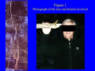 Figure 1 Photograph of the tree and branch involved 