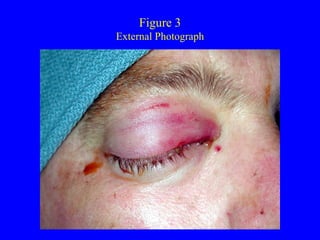 Figure 3  External Photograph  